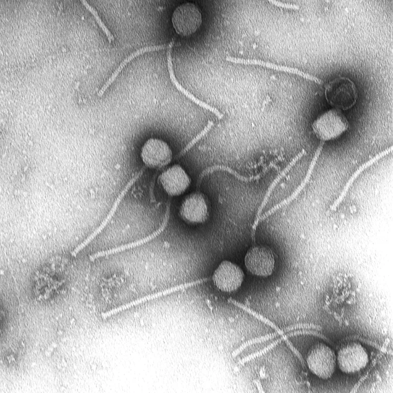 Discovery of HIV